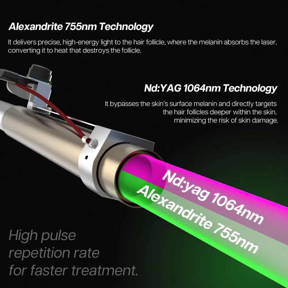 2025 New Technology Alex Laser Hair Removal 755nm 1064nm Longpulse Laser Alexandrite Laser