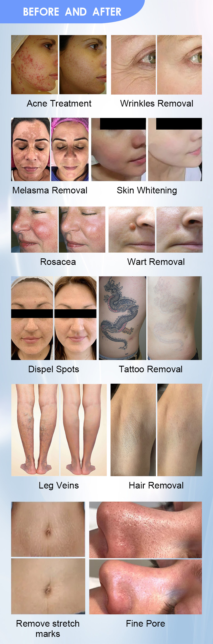Treatment Result 6