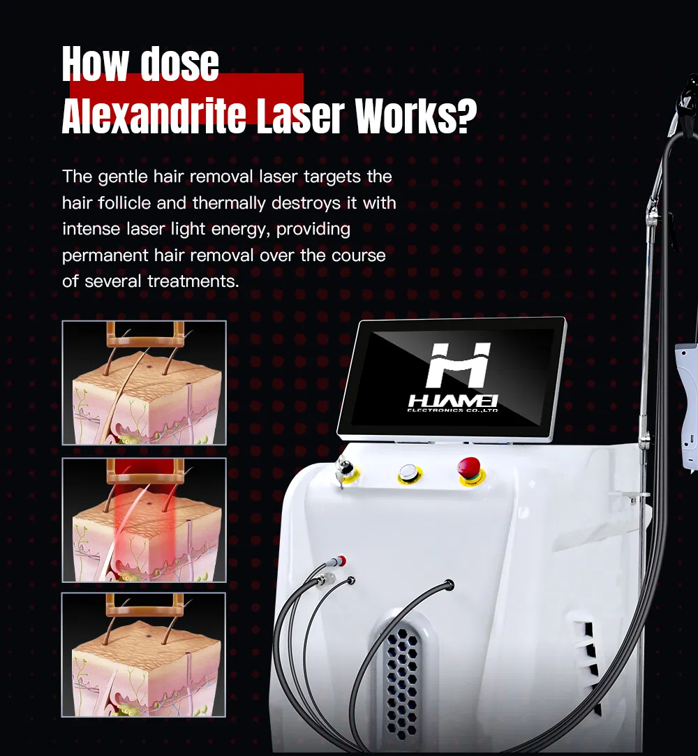 Newest Technology Alex Laser Hair Removal 755nm 1064nm Long Pulse Laser Alexandrite Laser