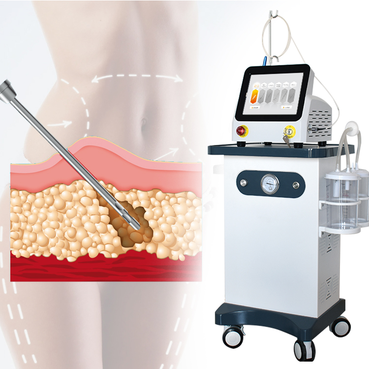 Mini Invasive Endolaser 980nm 1470nm Laser Facial Lift Liposuction Lipo Medical Laser Diode