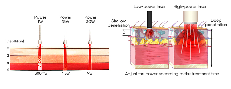 Laser Penetration Diagram