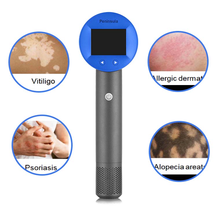 Peninsula Scalp Psoriasis Treatment Device OEM 308nm Led Red Light Therapy Device Excimer Laser Skin Care Product Machine