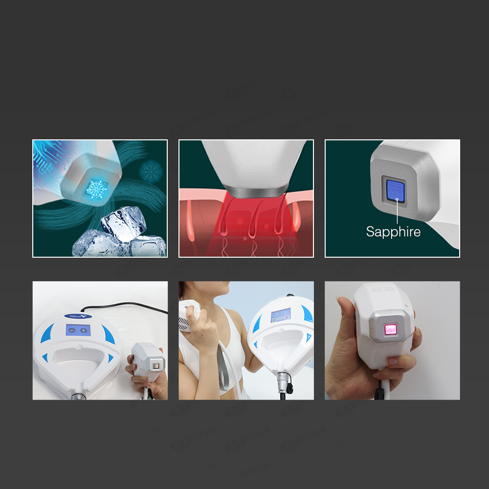 Easy Operation Fast Results Mini Hand Held Plastic Laser Hair Removal Machine Skin Rejuvenation Face Armpit Body Home Diode 808