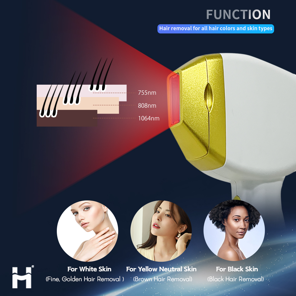 AI Skin System 4 Waves Diode Laser Hair Removal 808nm 755 940 1064nm USA Coherent Laser Bar Painless Fast Result Factory Price