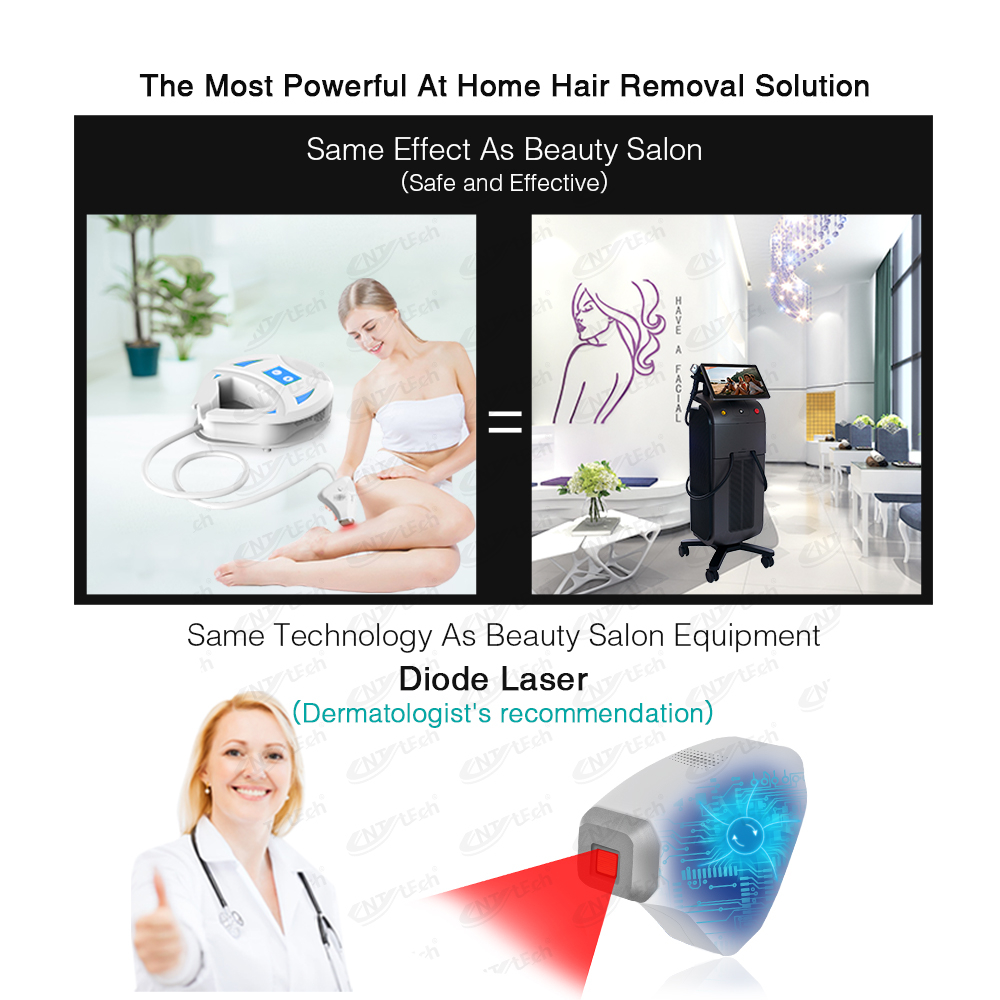 Mini laser hair removal machine side view