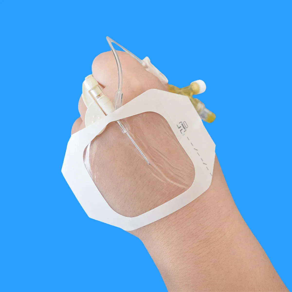 Transparent Wound Dressings with Frame Waterproof IV Cannula Fixation Dressing