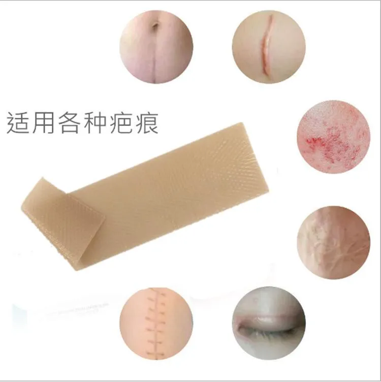 Scar Treatment Result