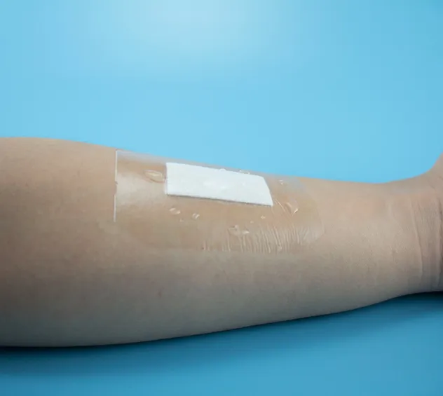 Wound Dressing Side View