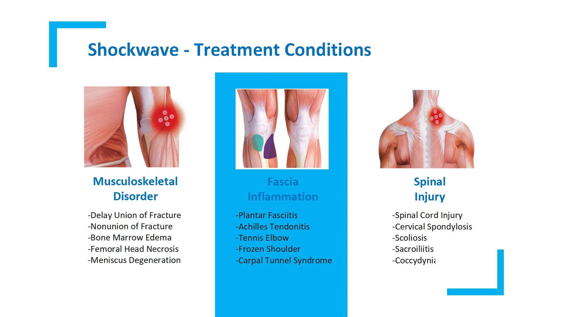 Gomecy Innovative Pain Management Equipment for Combining Pneumatic Ultrasound Ultra Deep Vibration Physical Therapy and RF Technology