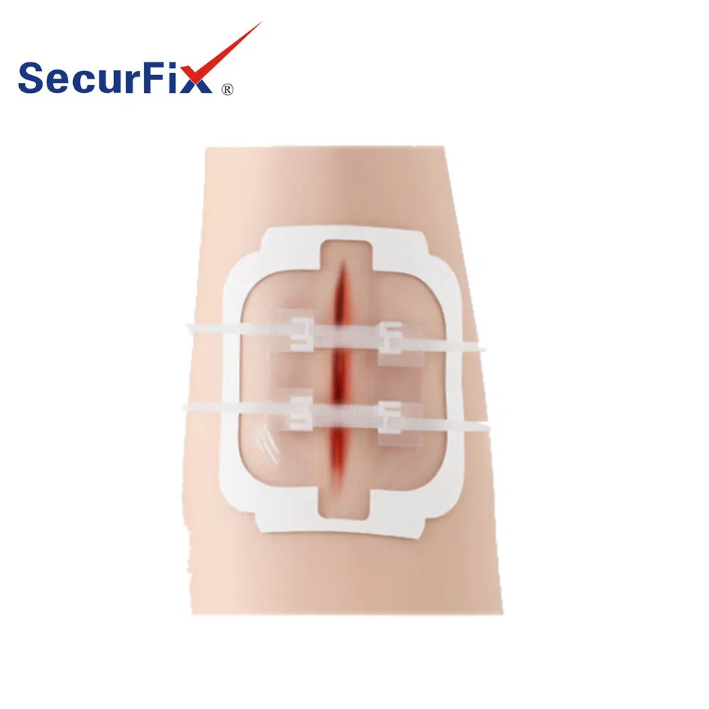Transparent PU Film Wound Closure Bandage 6cm*6cm Scar Reduction Tension Relieve Without Suture Surgical Dressing OEM Manufacturer