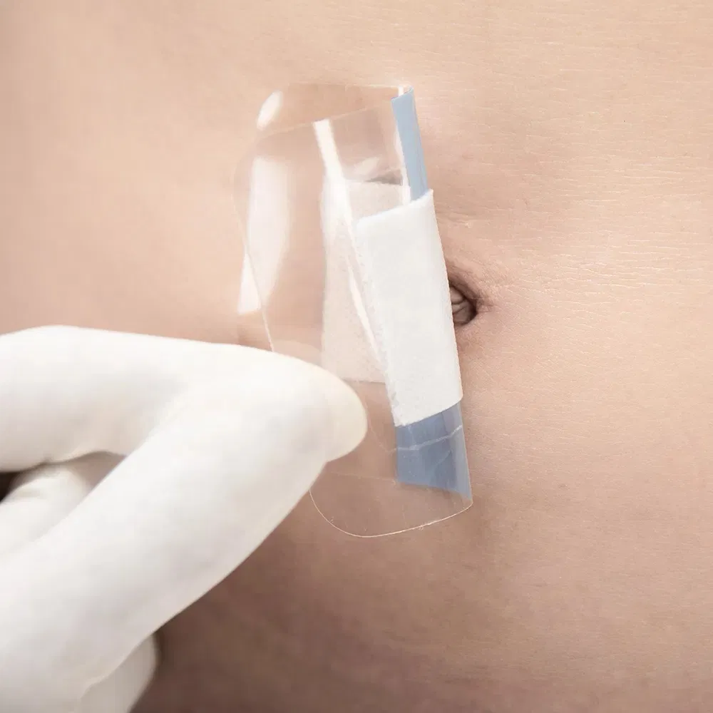 China Wound Dressing Manufacturer Supplier Waterproof Transparent PU 6X7cm Island Wound Dressing