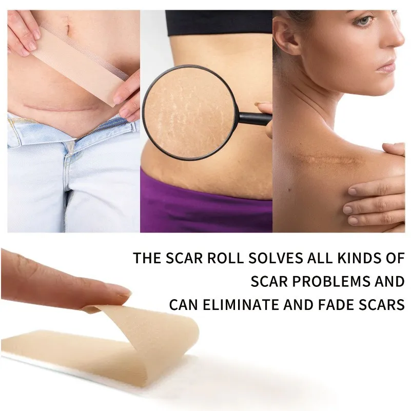 Scar Treatment