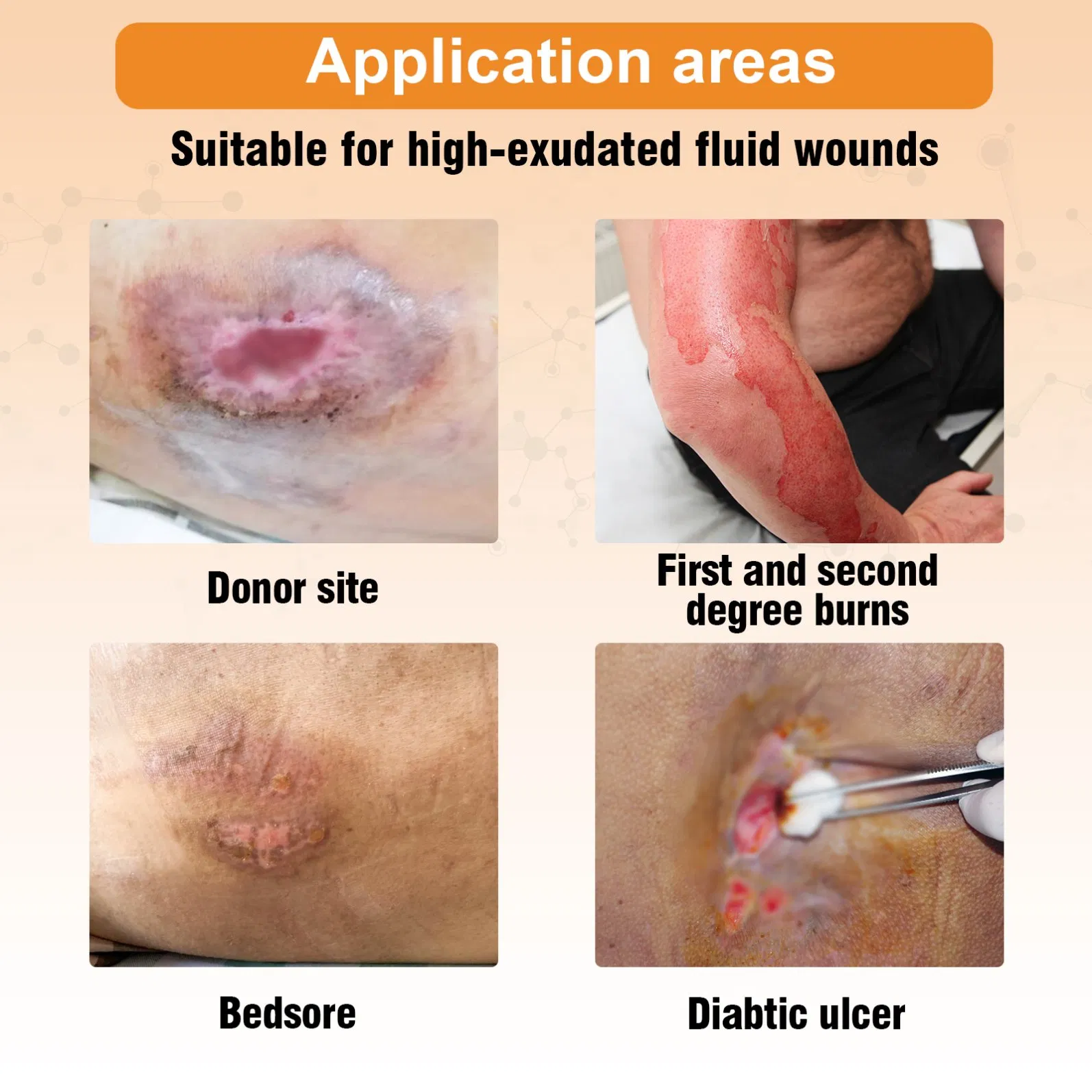 Wound Care Soft Adhesive Silicone Foam Dressing