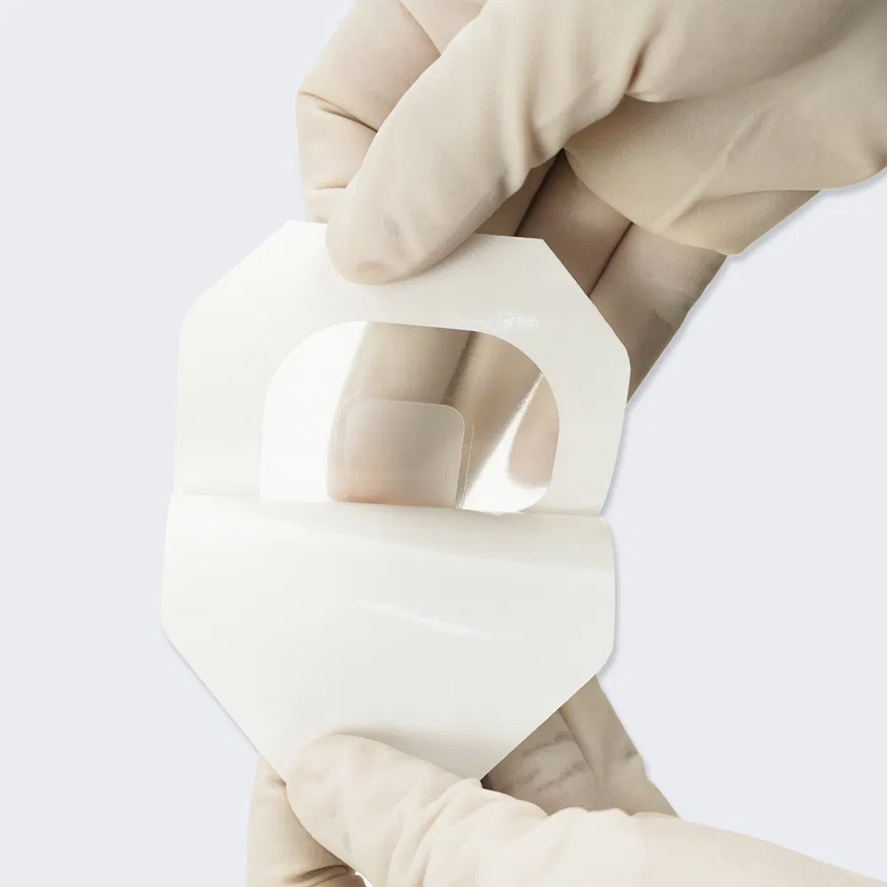 Wound Care Dressing 3