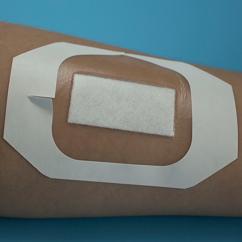 Sterilized Waterproof Transparent PU Film Wound Dressing with Absorbent Pad Wound Care