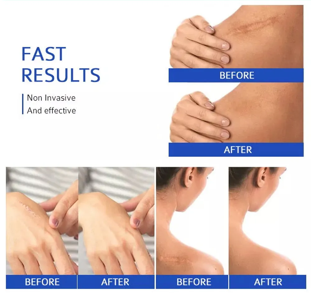 Soft Silicone Gel Sheet Reusable