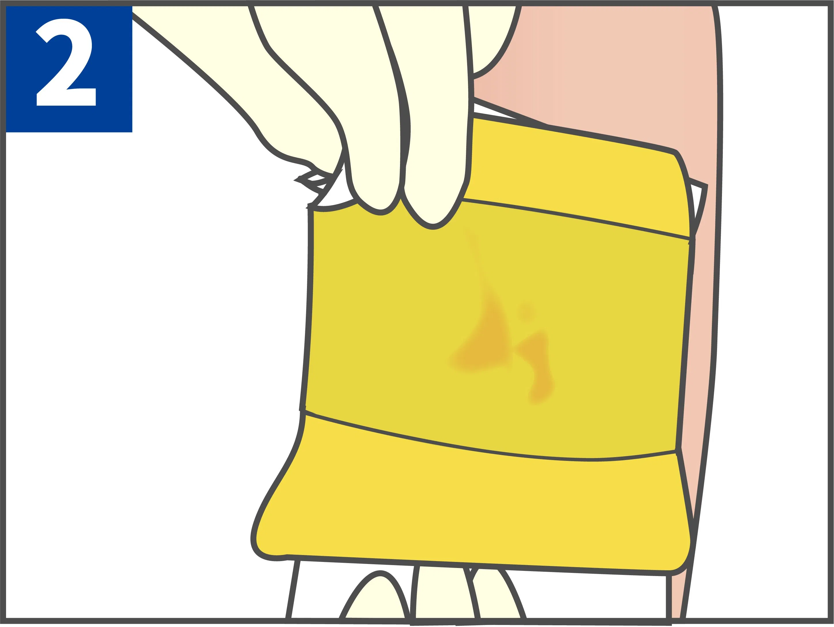 Waterproof Island Shape Medical Disposable Hydrocolloid Dressing for Surgical Wounds