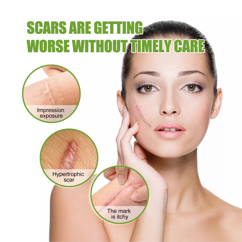Scar Healing and Skin Repair Silicone Scar Tape Silicone Scar Sheets