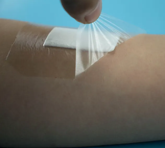 Wound Dressing Detail