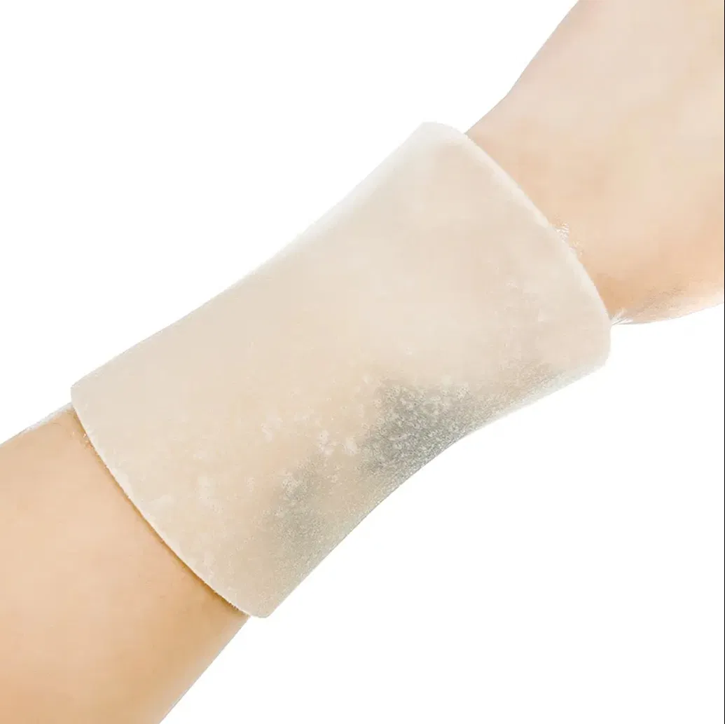 Hydrogel Burn Dressing