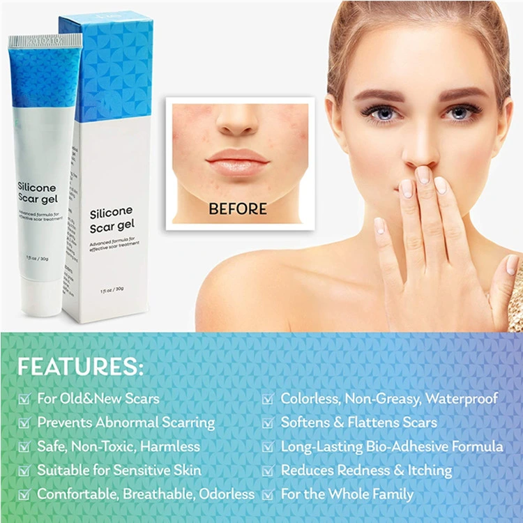 OEM Advanced Silicone Scar Treatment Face and Body Skin Repair Acne Gel