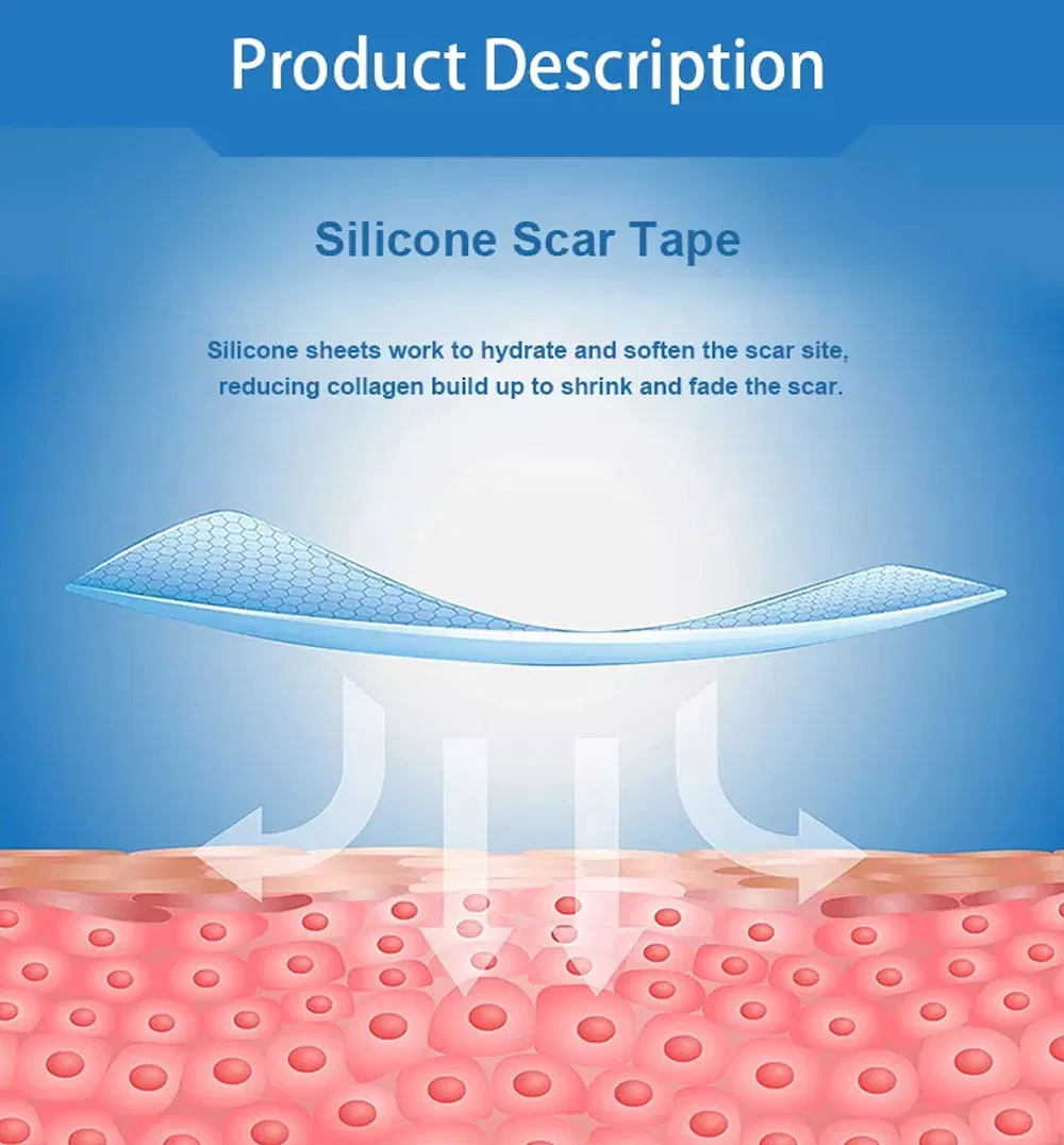 Silicone Gel Scar Dressing