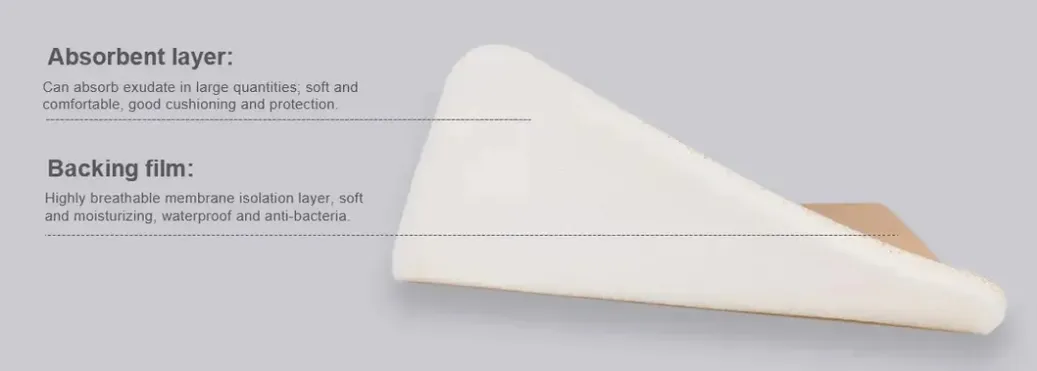 Wound Dressing Overview