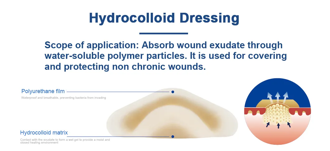 Hydrocolloid Mechanism