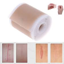 Surgical-Reusable Scar Removal Gel Tape