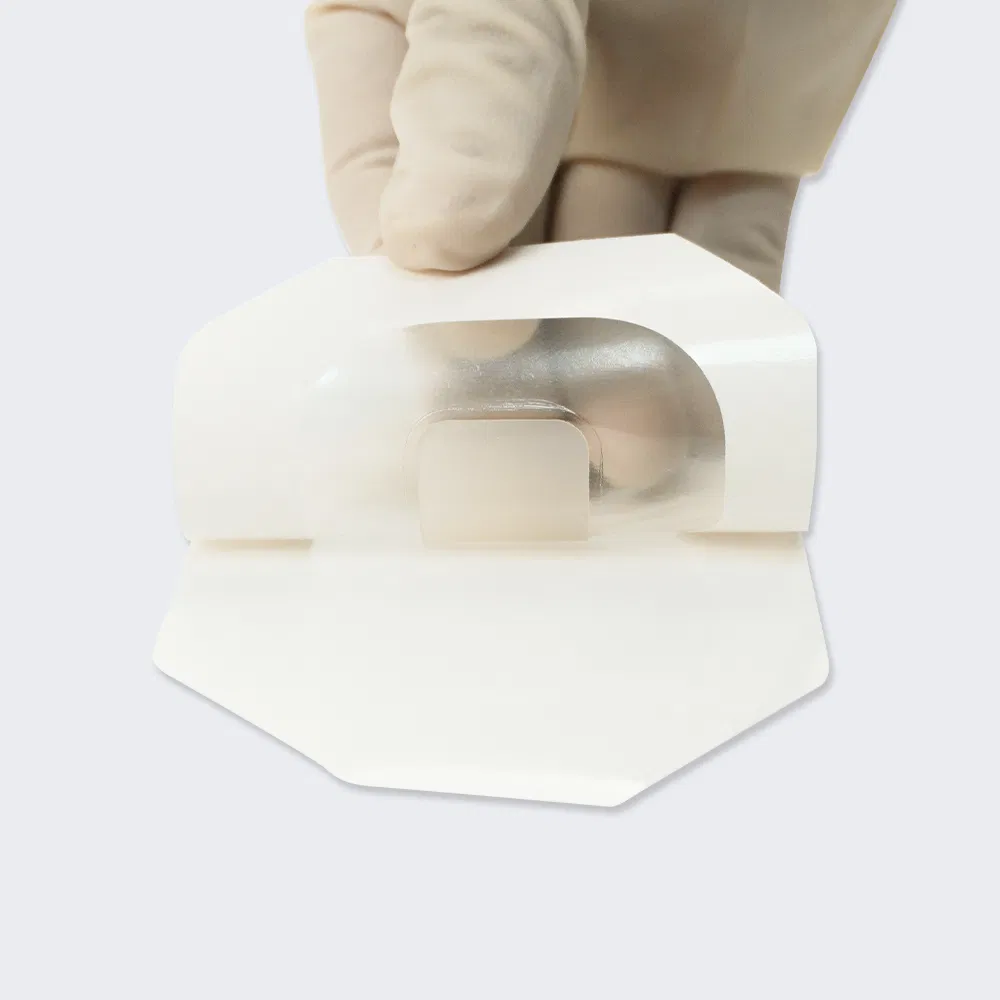 Wound Care Dressing 2