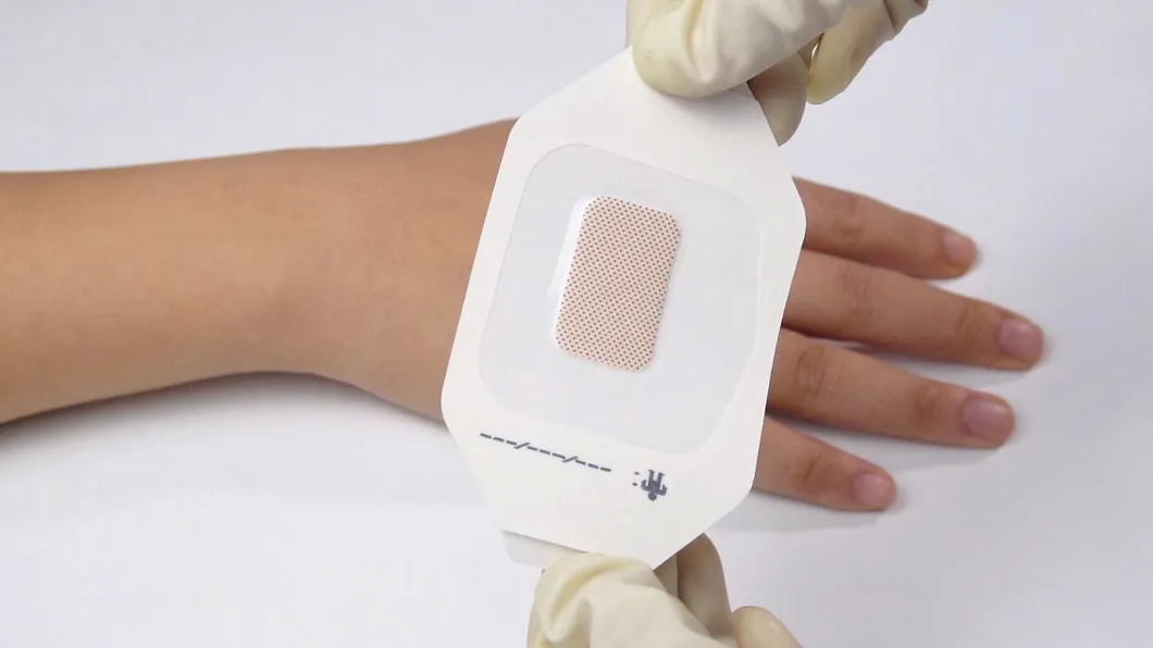 Wound Dressing Overview