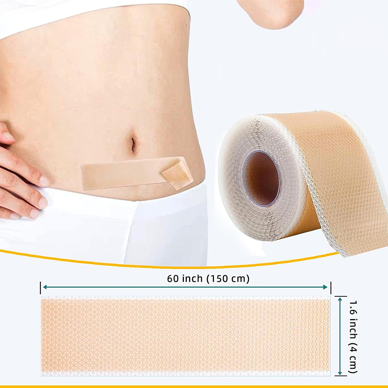 Durable Silicone Scar Sheets for Old and New Scars