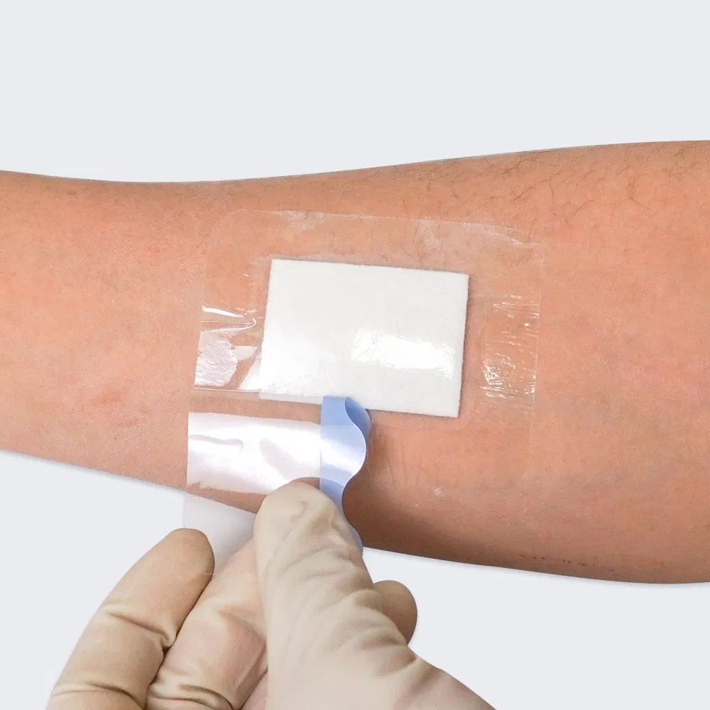 PU Transparent Film Dressing with Bordered Gauze Pads for Medical Wound Dressing
