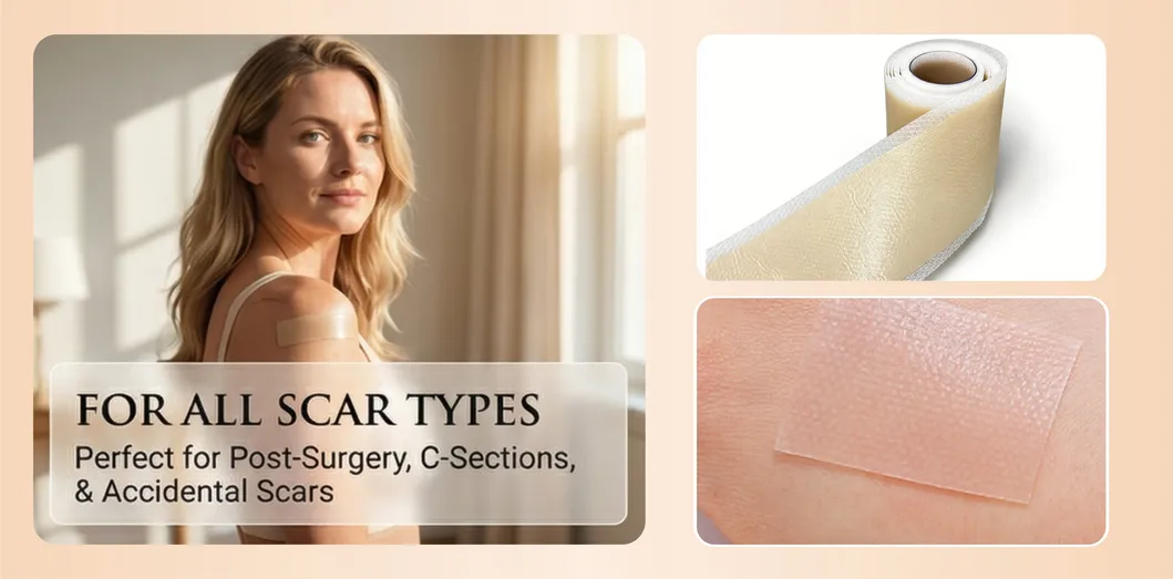 Silicone Scar Repair Tape Detail 3