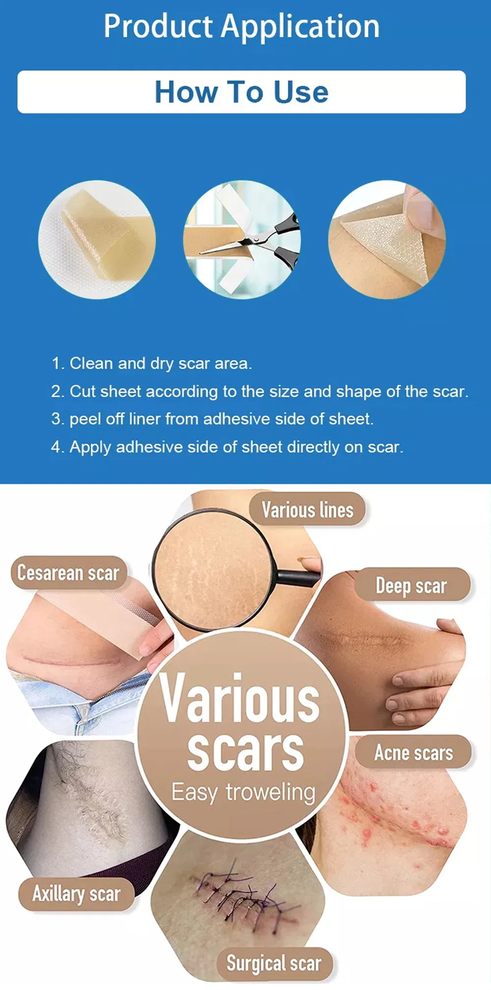 Medical Grade Scar Sheet Description
