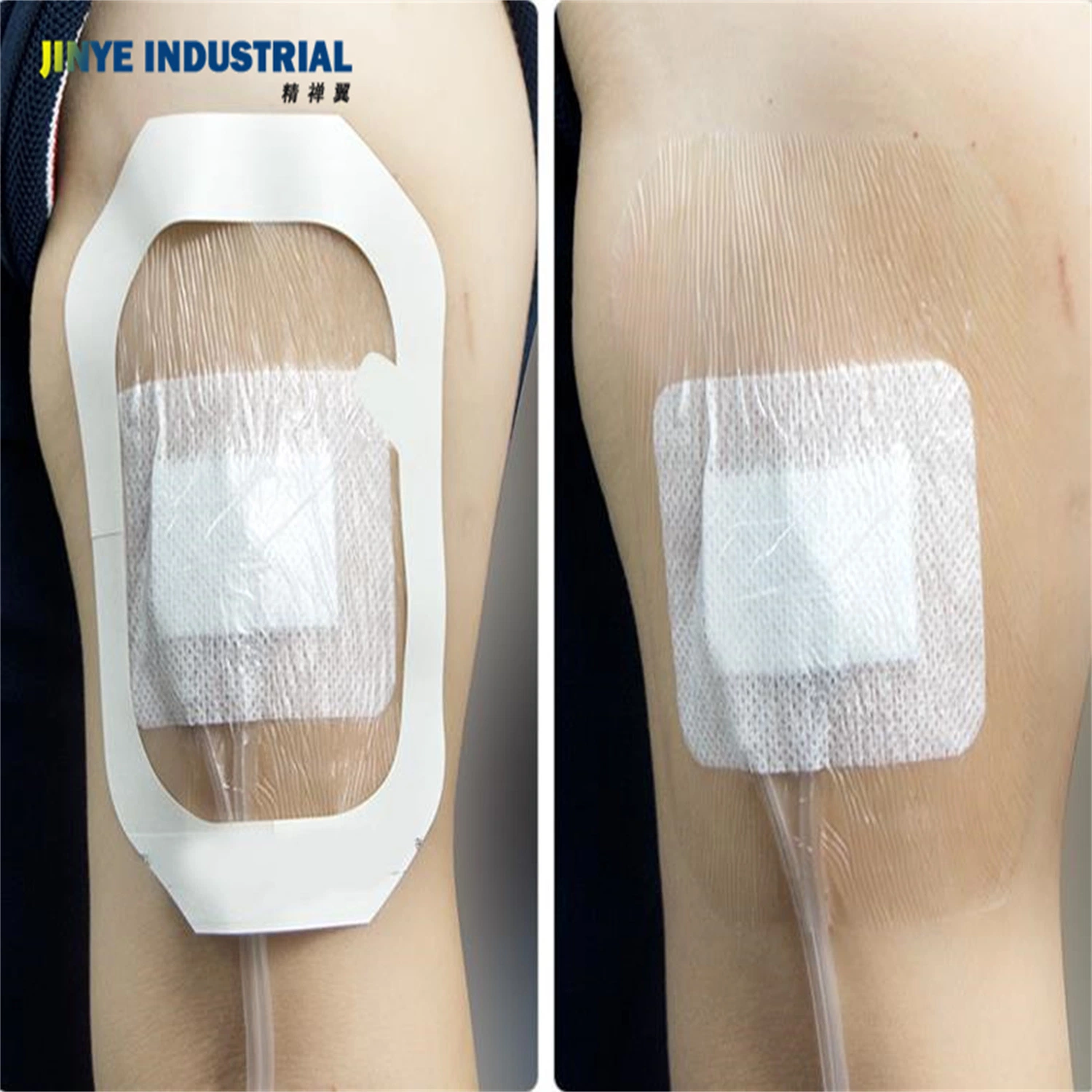 PU Transparent Island Dressing Transparent Waterproof Wound Dressing