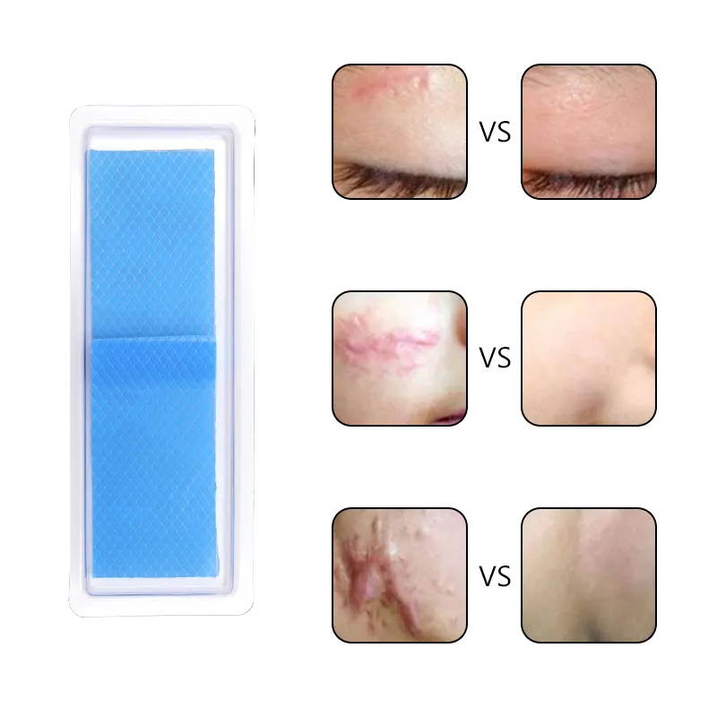 Silicone Scar Sheet Main