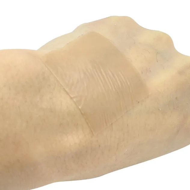 Silicone Scar Sheet Usage 3