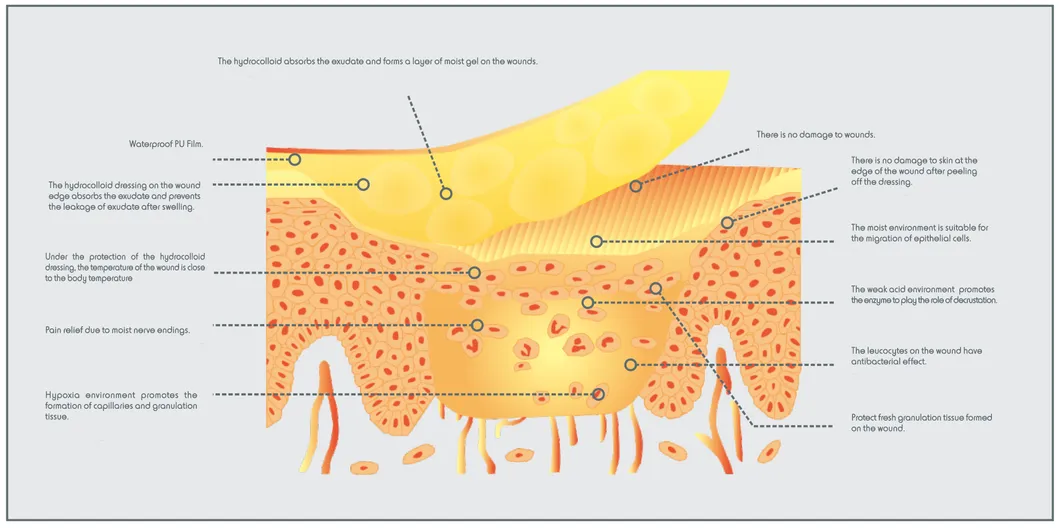 Dressing performance