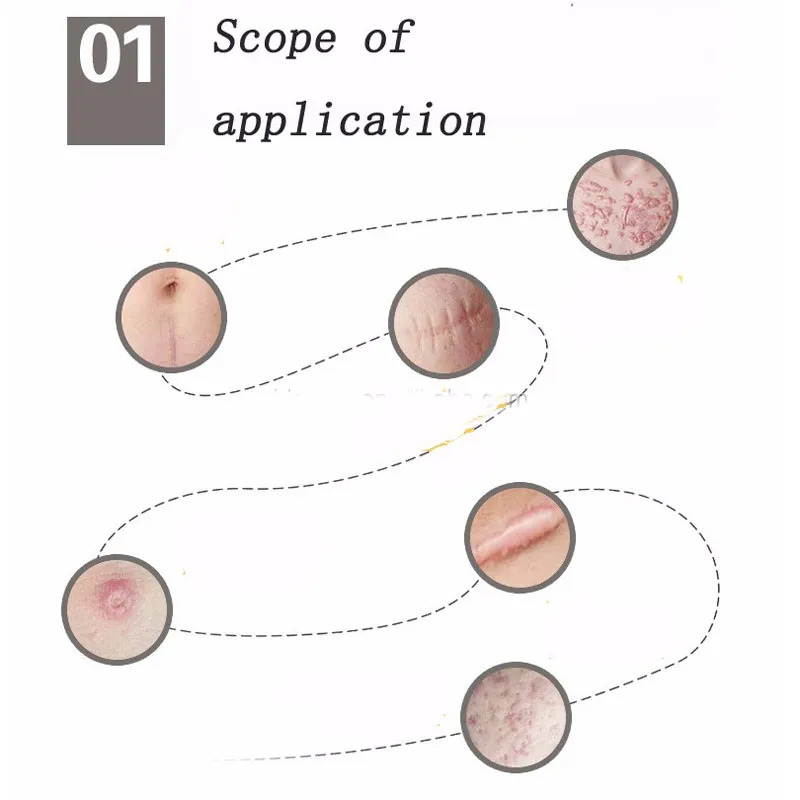 Silicone Scar Gel Sheet Usage 1