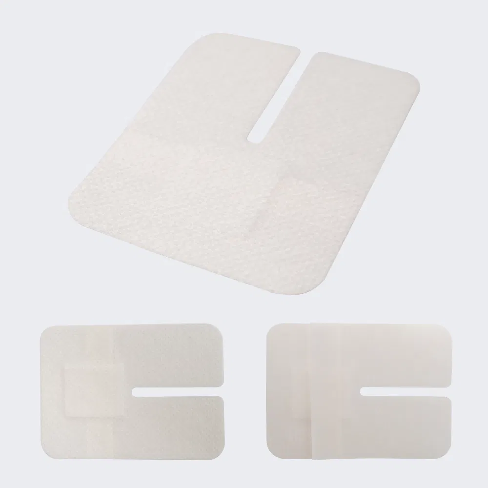 Disposable Waterproof Self-Adhesive I. V. Cannula Fixing Dressing Non Woven Island Wound Plaster with Pad