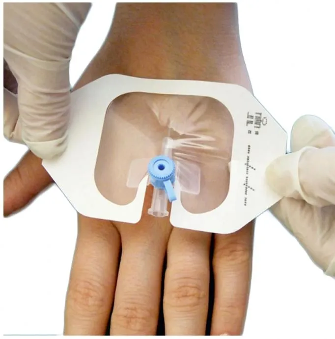 Medical Waterproof Non-Woven Wound Adhesive Island Dressing I. V Cannula