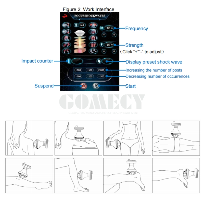 Piezo Focus Shockwave Therapy Device for Chronic Pain Management