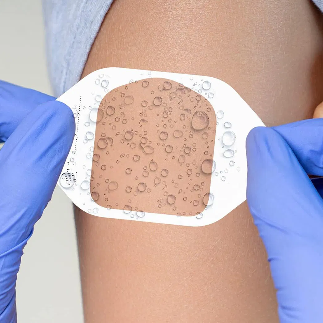 Transparent Wound Dressings with Frame Waterproof IV Cannula Fixation Dressing