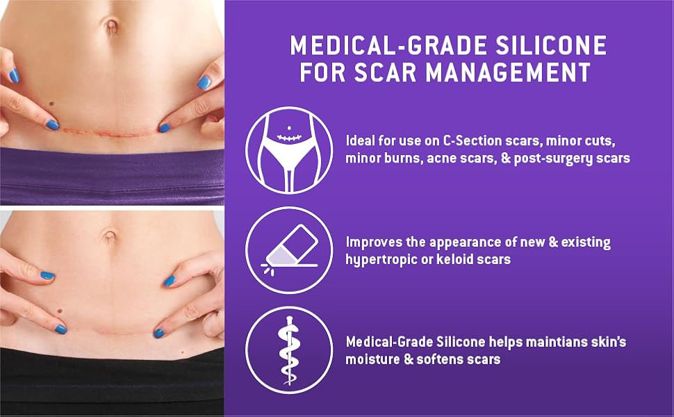 OEM ODM Silicone Scar Gel Treatment Skin Care