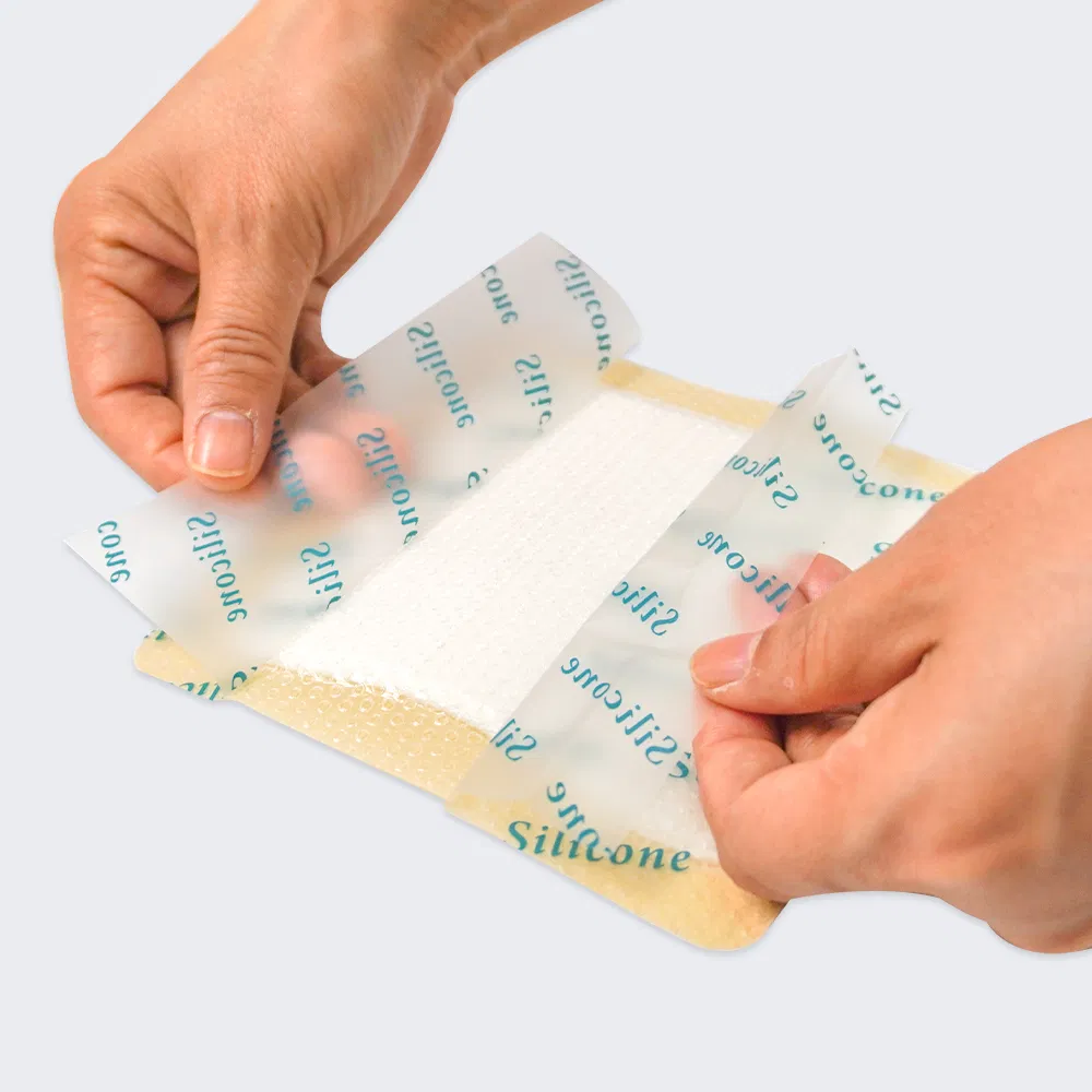 Silicone Foam Dressing 4