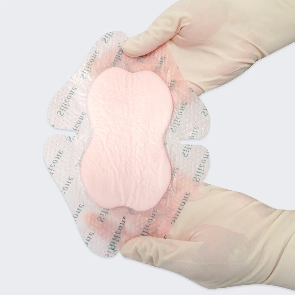 Silicone Dressing Photo 2