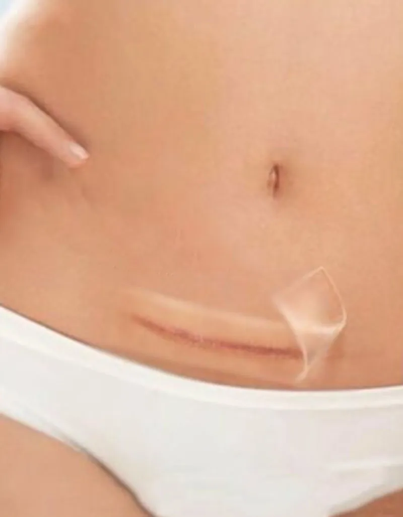 Silicone Gel Sheet Full View