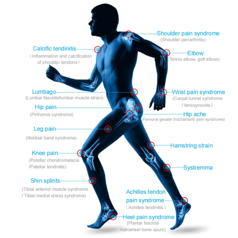 Non Invasive Green Therapy Focused Shockwave Machine for Safe Effective Pain Management