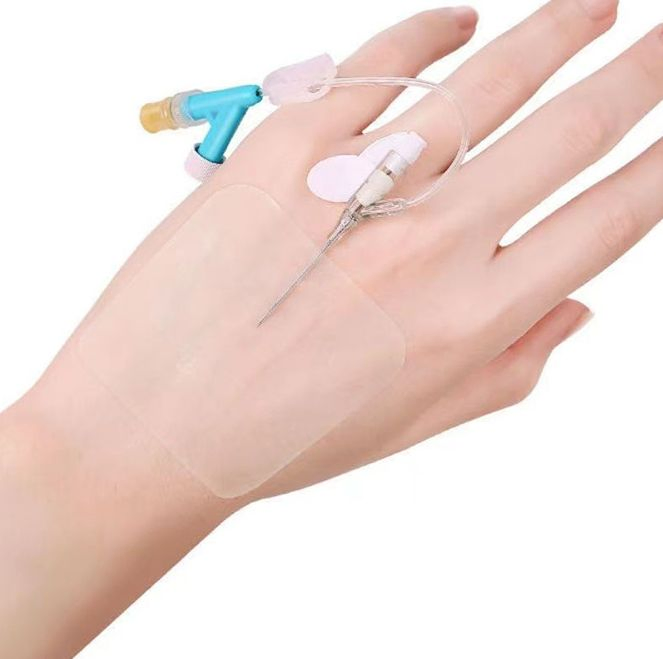 Skin Friendly Transparent Waterproof Plaster Wound Dressing for Indwelling Needle Fixation